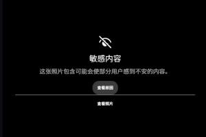 ?露骨！慎入！范德彪小拇指的骨头直接刺出来了！